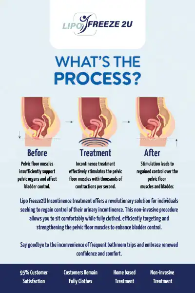 Diagram of how incontinence treatment Chester works.