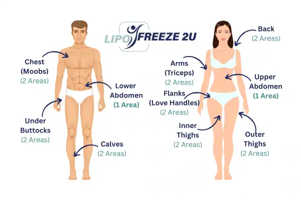 Areas you can have fat freezing treatment Chester