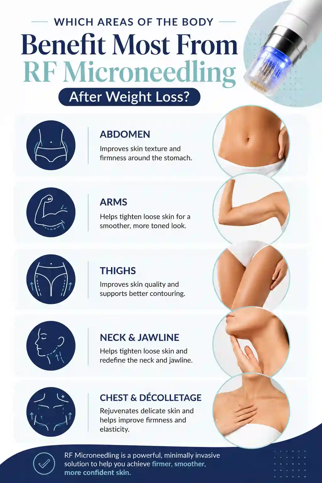 Which Areas of the Body Benefit Most From RF Microneedling After Weight Loss Chester
